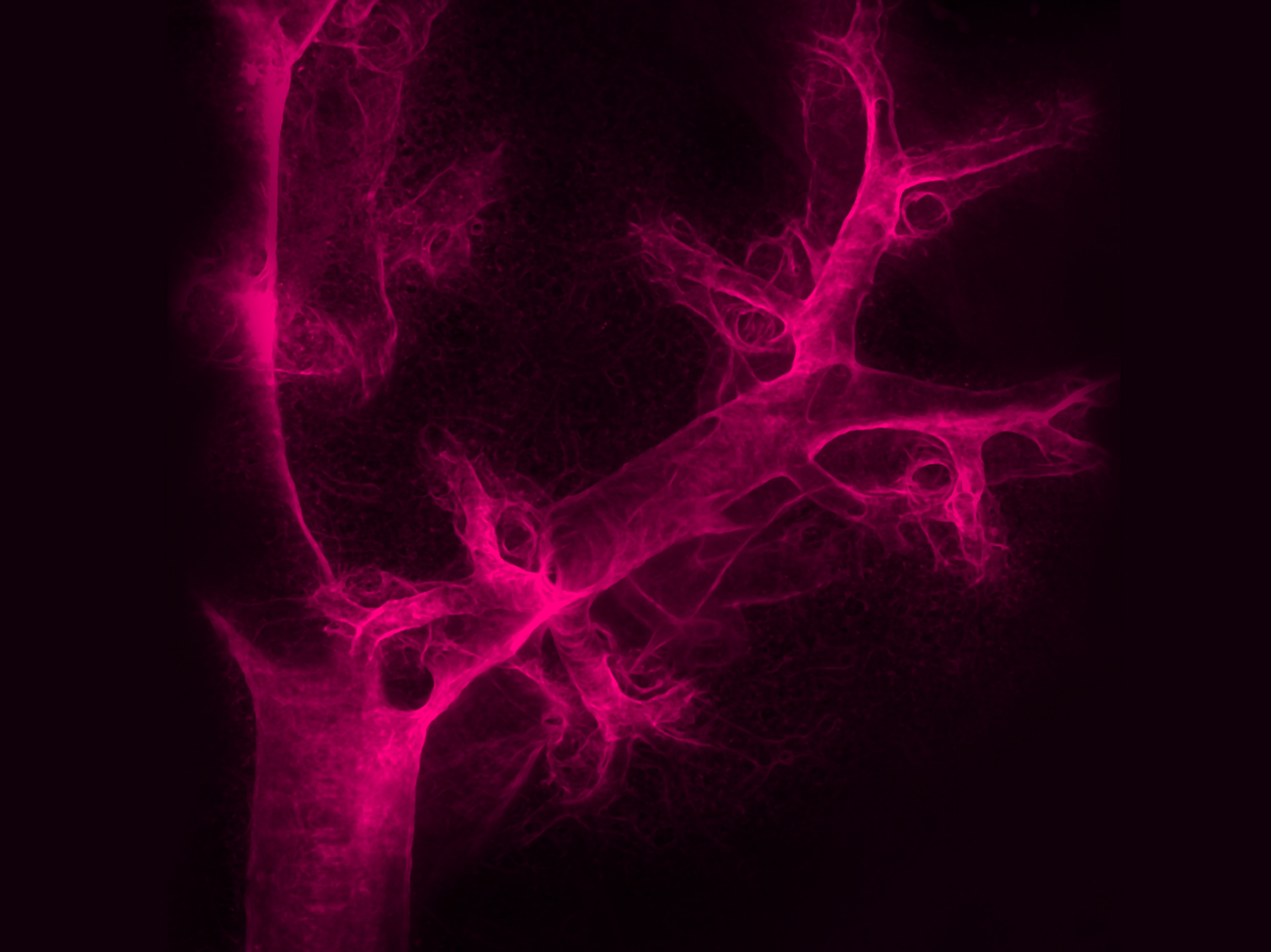 Blood vessels are seen branching out into the tissue of the lung in this 3D light sheet microscope image