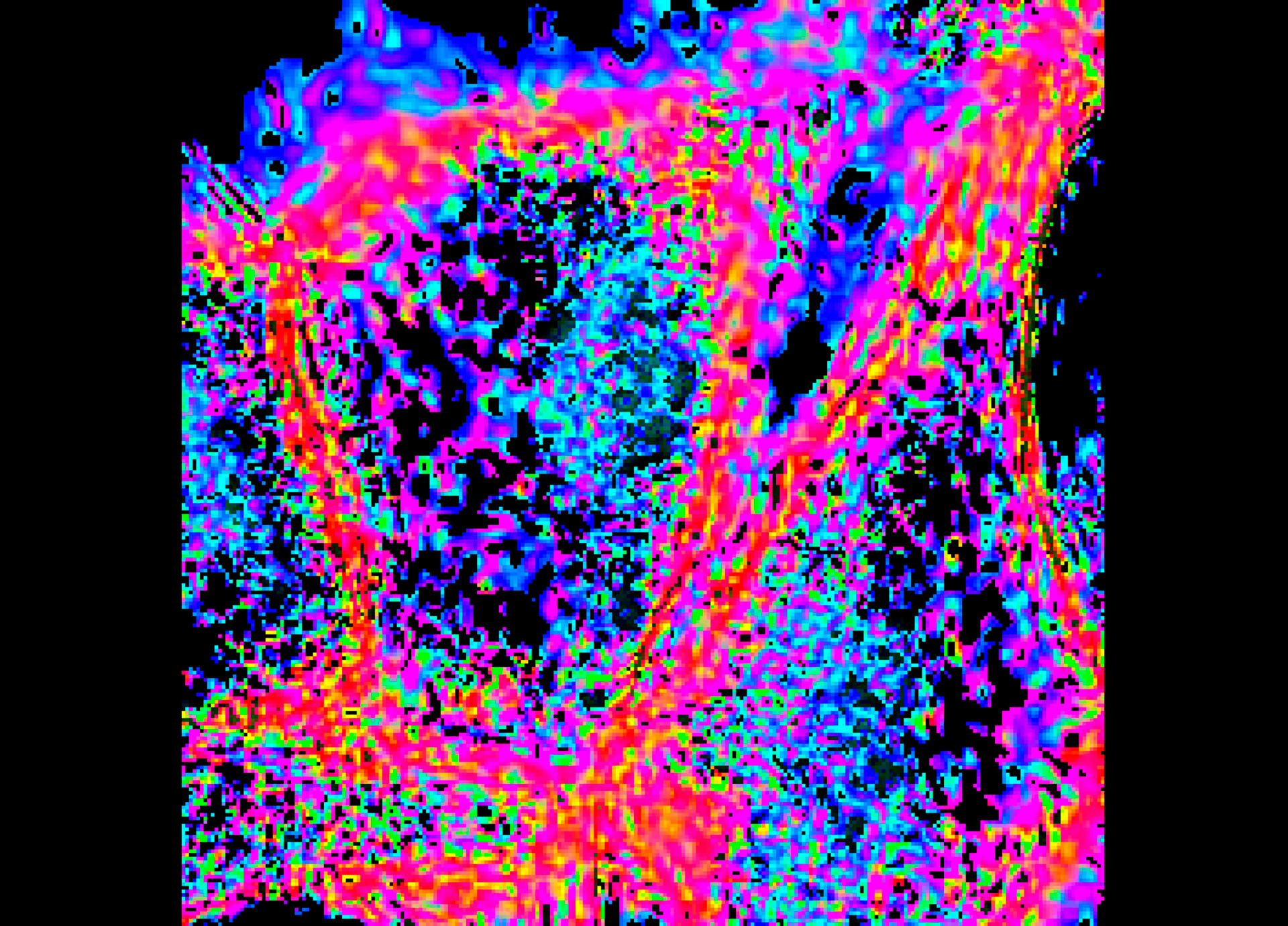 Vibrant, pixelated colours in this image of skin cells