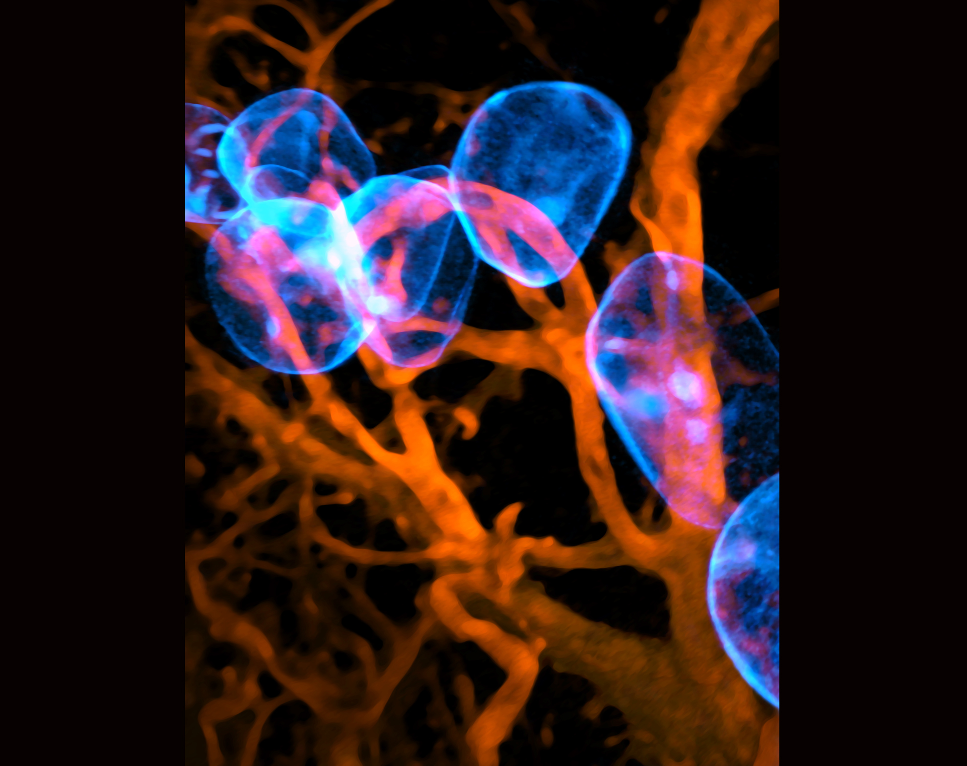 Microscope image of fat cells surrounded by red blood vessels in breast tissue