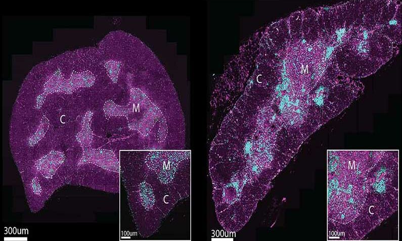 Pictured are the cells that form clusters in the thymus with age. On the left, the thymus from a two-month-old mouse has few age-associated (in blue) clusters. On the right, the thymus from a 24-month-old mouse shows many clusters. Researchers have found these clusters form ‘scars’ in the thymus which prevent the organ from restoring itself after damage.